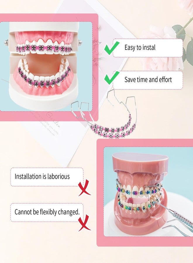 Xorim Brackets Falsos Para Dientes Kit 2 Pack, Braces Kit with Brackets & Wire & Glue, Brackets Para Dientes DIY Retainer for Teeth, Dental Student Practice Props (Pink) - Image 5