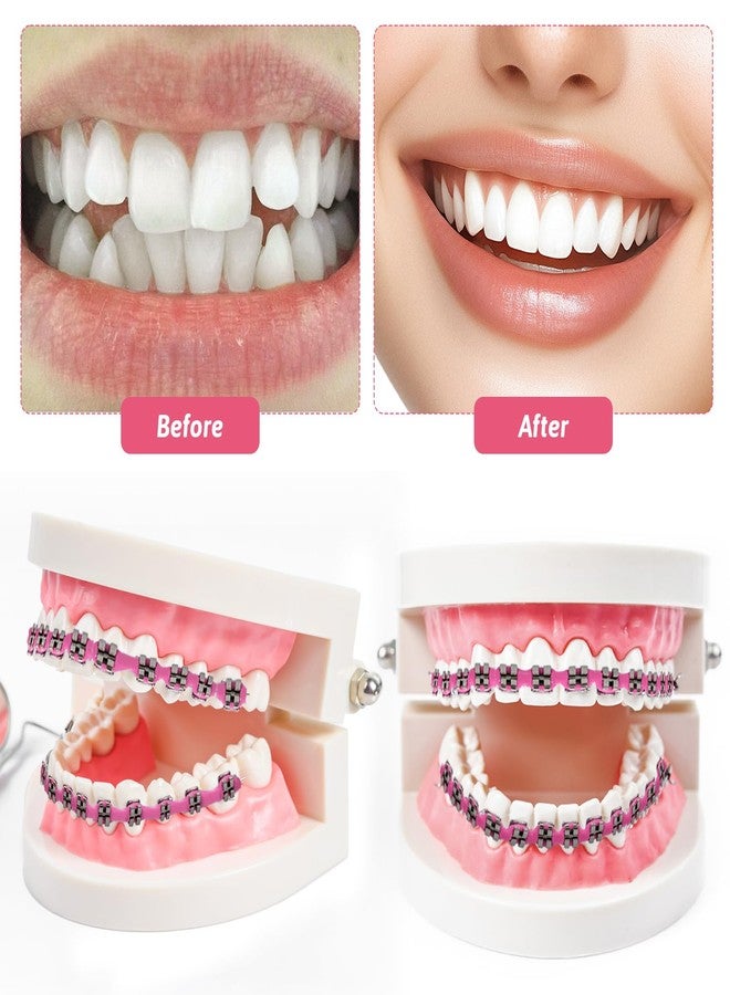Xorim Brackets Falsos Para Dientes Kit 2 Pack, Braces Kit with Brackets & Wire & Glue, Brackets Para Dientes DIY Retainer for Teeth, Dental Student Practice Props (Pink) - Image 3