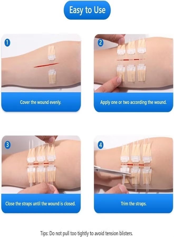 general 3 Pcs Zip Stitch Wound Closure Device Emergency Zipstitch Laceration Kit Bandages with sterile Strips Painless Laceration Repair Without Stitches Wound Care First Aid - Image 3