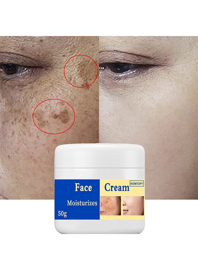 HOMTOPY Face Cream，Dark Spot Remover for Face, Melasma Treatment, Hyperpigmentation Corrector, Spot Cream with Vitamin C and Glycerol, Fades Sun Spots and Freckles for Even Skin Tone 50g - Image 1