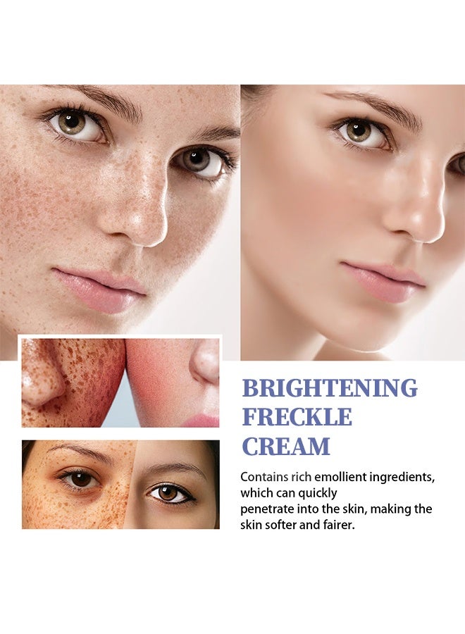 HOMTOPY Face Cream，Dark Spot Remover for Face, Melasma Treatment, Hyperpigmentation Corrector, Spot Cream with Vitamin C and Glycerol, Fades Sun Spots and Freckles for Even Skin Tone 50g - Image 2