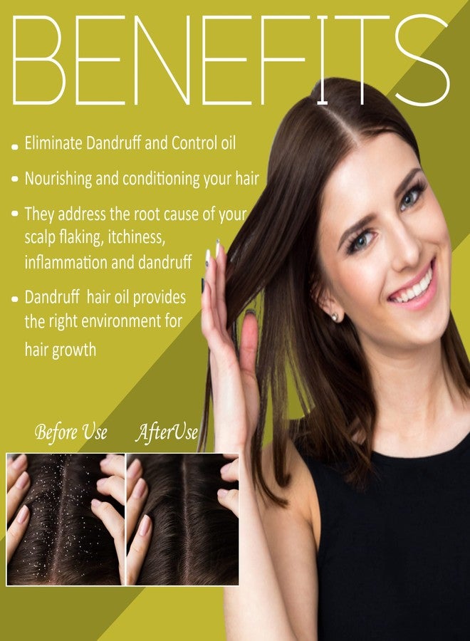 الجذر الوردي زيت بينك روت للتحكم في قشرة الرأس 100 مل | يساعد في تقليل القشرة، ويمنع الحكة، ويغذي فروة الرأس | زيت للشعر - Image 2