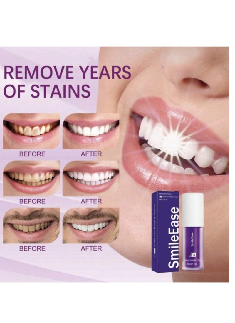 SmileEase SmileEase Teeth Brightening V34 Colour Corrector Serum 30ml 1fl oz  - Image 2