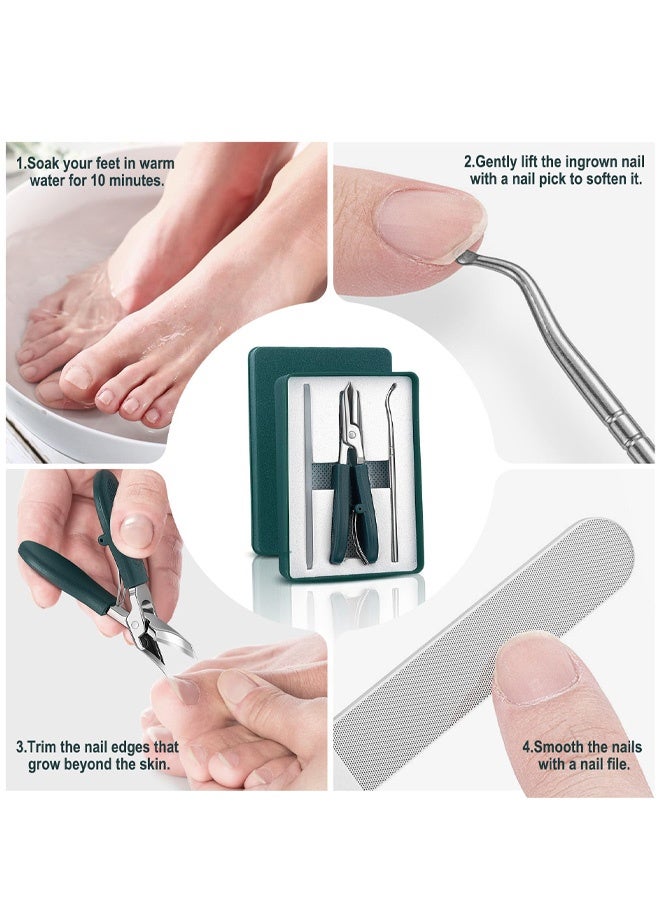 3PCS Ingrown Toenail Clippers Set, Beveled Eagle Beak Nail Clippers for Thick Nails, for Elderly Men Women - Image 4