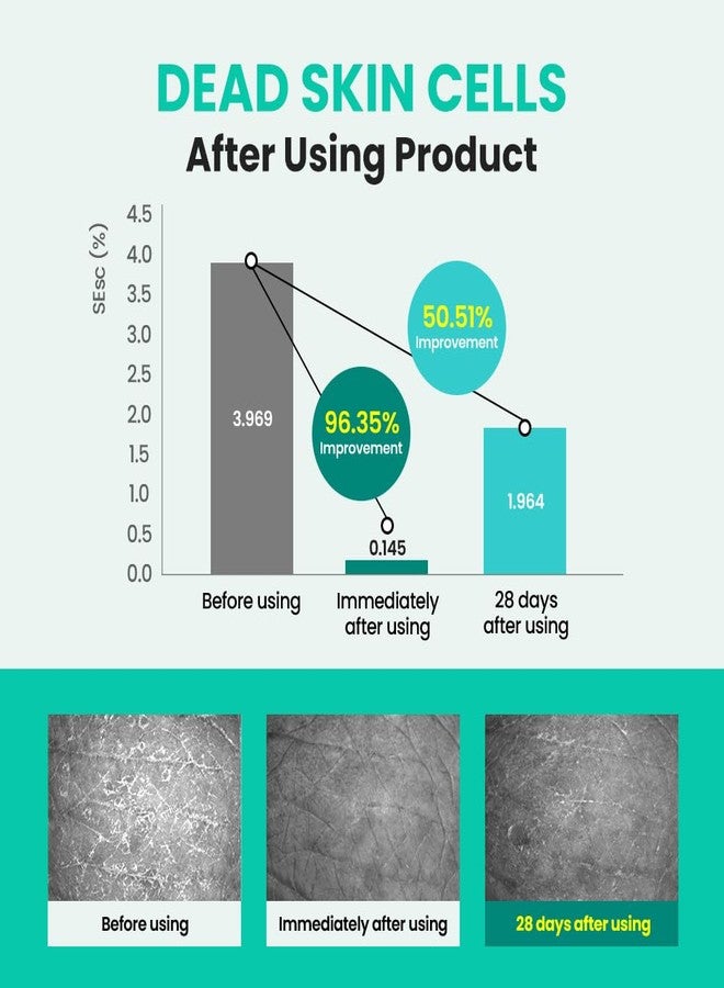 Real Barrier | Porebium Peeling Toner | Face Toner for Blackhead Control | Dead Skin Cells Exfoliator for Sensitive Skin | No Sebum Solution for Oily Skin | Korean Skincare |10.31 fl oz (305ml) - Image 5