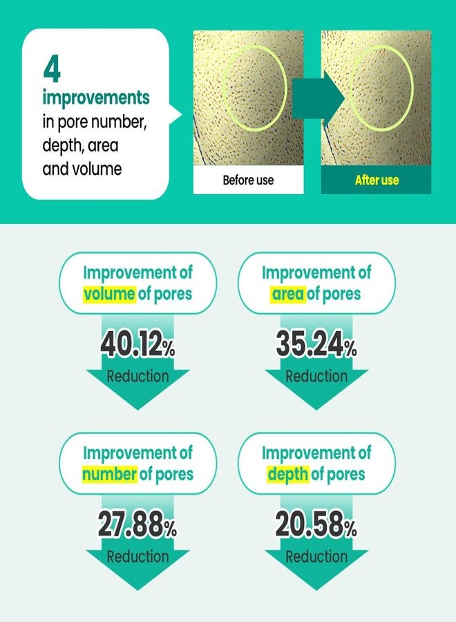 Real Barrier | Porebium Peeling Toner | Face Toner for Blackhead Control | Dead Skin Cells Exfoliator for Sensitive Skin | No Sebum Solution for Oily Skin | Korean Skincare |10.31 fl oz (305ml) - Image 4