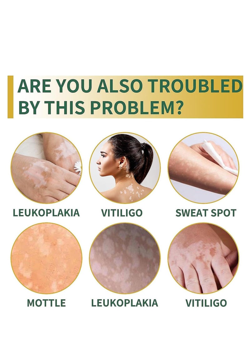 Sumifun White Spot Soothing Cream, Natural Vitiligo Treatment, Repair Patchy Skin, Reduce White Spots, Improve Skin Pigmentation, Restore Skin Tone, Effective External Care Ointment for Vitiligo 20g - Image 2