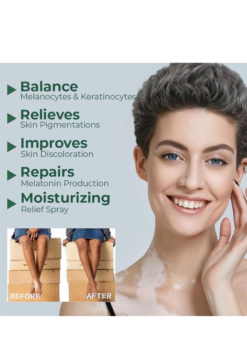 Sumifun White Spot Soothing Cream, Natural Vitiligo Treatment, Repair Patchy Skin, Reduce White Spots, Improve Skin Pigmentation, Restore Skin Tone, Effective External Care Ointment for Vitiligo 20g - Image 4