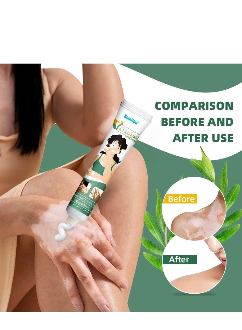 Sumifun White Spot Soothing Cream, Natural Vitiligo Treatment, Repair Patchy Skin, Reduce White Spots, Improve Skin Pigmentation, Restore Skin Tone, Effective External Care Ointment for Vitiligo 20g - Image 5