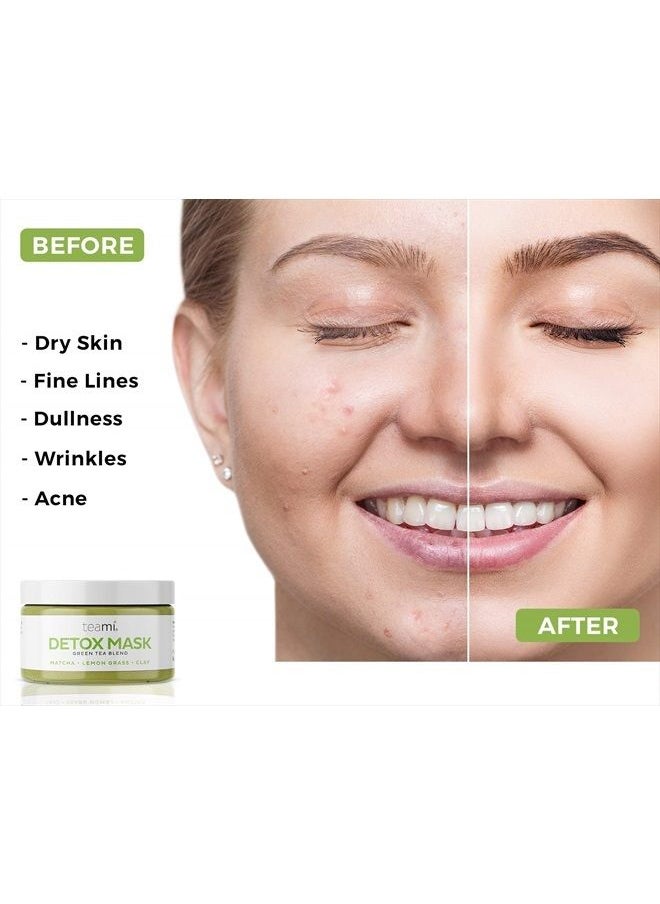teami - Detox Mud/Face Masks with Bentonite Clay, Skincare Facial Products, Green Tea Deep Cleansing Pore Minimizer & Blackhead Remover For Spa Day Exfoilate & Acne Care - Image 1