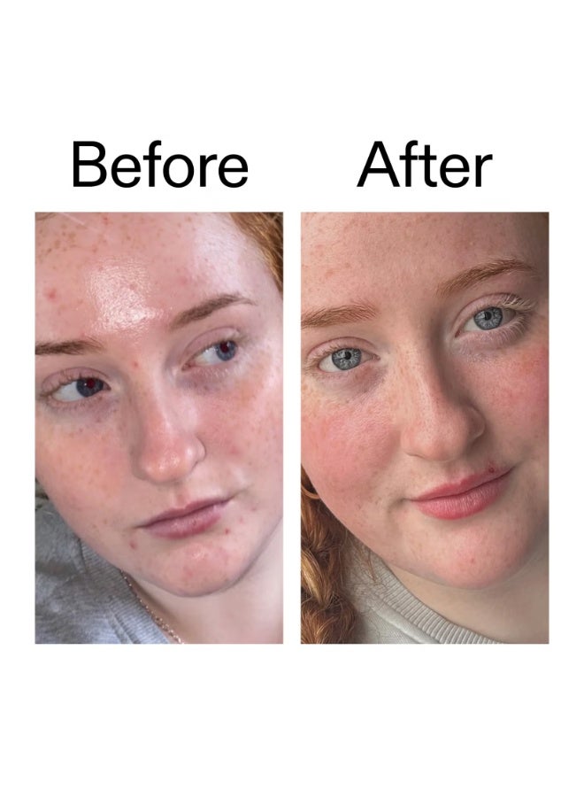 مرطب إنكي ليست بفيتامينات ب، ج، و هـ 50 مل - Image 4