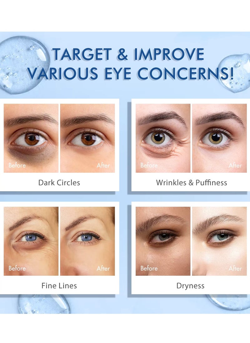 Yecuce - Advanced Eye Serum Caffeine Eye Cream for Dark Circles and Wrinkles 5% Caffeine Under Eye Cream Reduce Wrinkles Relieve Puffiness and Fine Lines Daily Eye Serum with 360 Roller  Anti Aging Eye Cream 15ml - Image 1