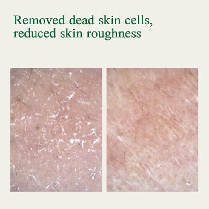 Pyunkang Yul PKY Ultimate Calming Solution Ampoule for Sensitive Skin with Patented Ingredients, Serum Intensely Calms & Soothes Redness with Cica & Tea Tree, Korean Skincare (1.01 Fl. Oz, 30ml) - Image 5