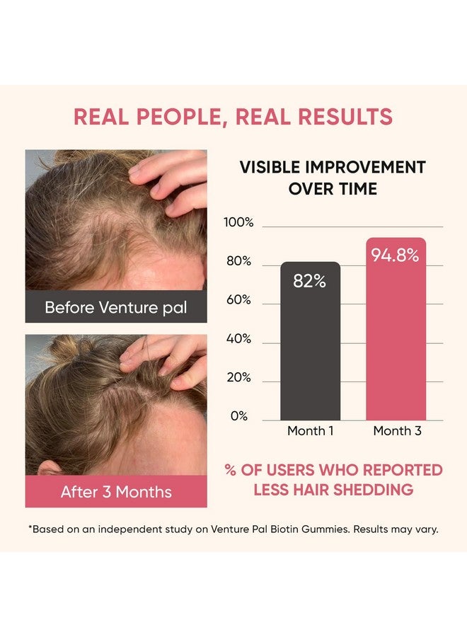 فينشر بال حلوى فينشر بال بيوتين مع الكولاجين والكيراتين - فيتامينات لدعم نمو الشعر وتقوية البشرة والأظافر للنساء والرجال - بيوتين ١٠٠٠٠ ميكروغرام | فيتامين ب المركب | بالميتو المنشاري - خالية من السكر، غير معدلة وراثيًا، ٦٠ قرصًا - Image 5