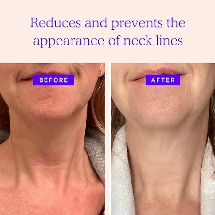 BLUMBODY Neck Wrinkle Patches – Anti-Wrinkle Silicone Patches for Skin Firming, Tightening – Reusable Overnight Pads – Anti-Aging Crepe Erase Pads – Neck, Décolleté (2-Month Supply) - Image 2