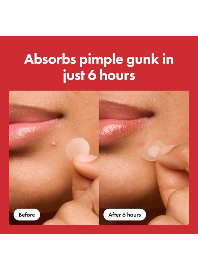 Mighty Patch Original Patch from Hero Cosmetics - #1 Hydrocolloid Acne Pimple Patches for Face, Shrinking Zits & Whiteheads in 1 Use, Nighttime Spot Pimple Stickers for Face, 75 Count - Image 4