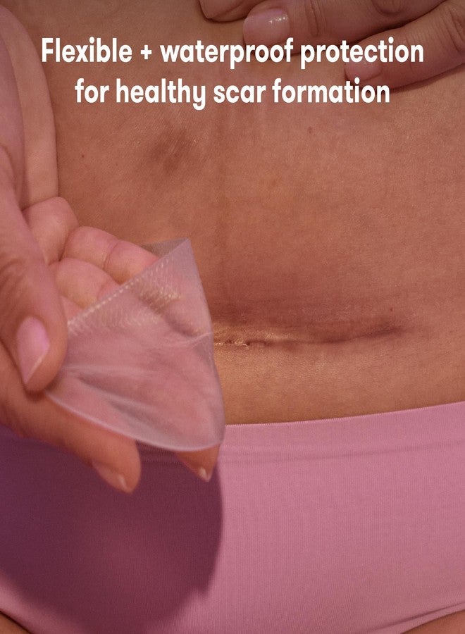 Frida Mom شرائط سيليكون فريدا موم لعملية القيصرية، لاصقات شفاء القيصرية الضرورية، علاج طبي قابل لإعادة الاستخدام لندبات الكيلويد، تشمل علبة وحقيبة - Image 2