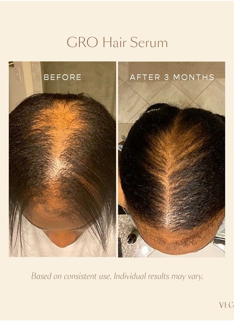 VEGAMOUR - Vigamore Grow Hair Growth Serum for Visibly Thicker and Longer Hair Botanical Hair Growth Serum Designed to Reduce Hair Loss 30ml - Image 1