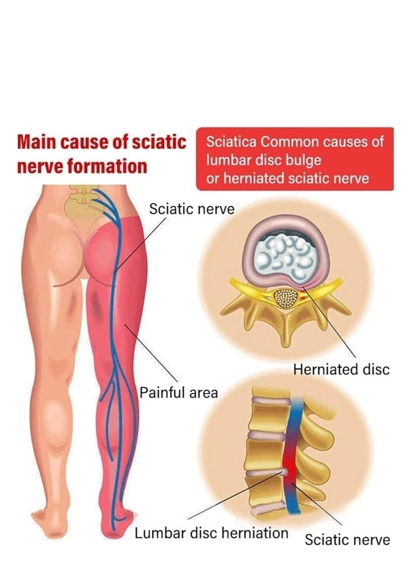 EELHOE 2 PCS Knee Pain Relief Spray - Lumbar Spine Cold Gel Spray, Knee Joint Pain Relief Supplements, Herbs Bruise Spray, Arthritis Pain Relief, Relief Muscle Crampï¼Natural Pain Reliever Spray - Image 4