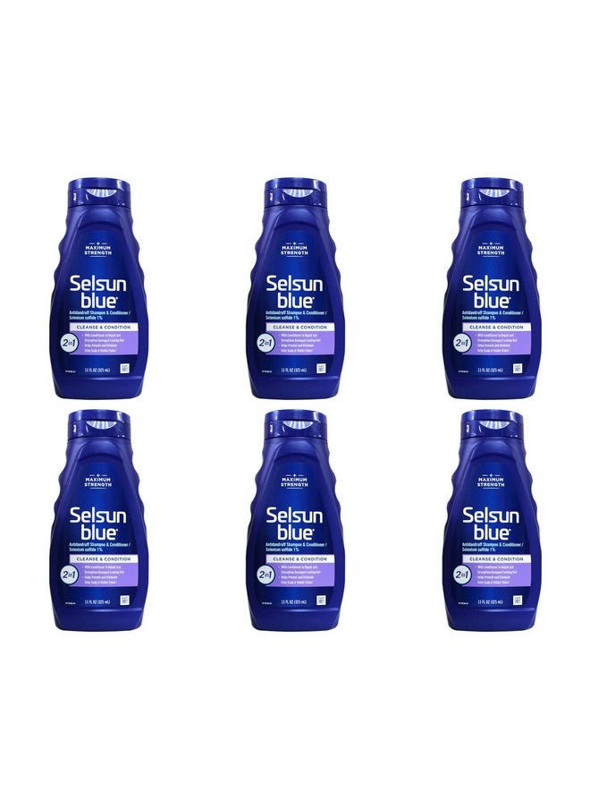 Selsun blue Selsun Blue Shampoo Naturals Dandruff 2-In-1 Strength 11 Ounce (325ml) (6 Pack)  - Image 1