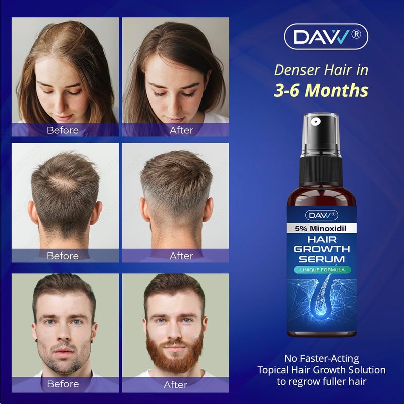DAVV Minoxidil for Men Hair Growth Serum: Minoxidil 5 Percent - 1.5 - Image 2