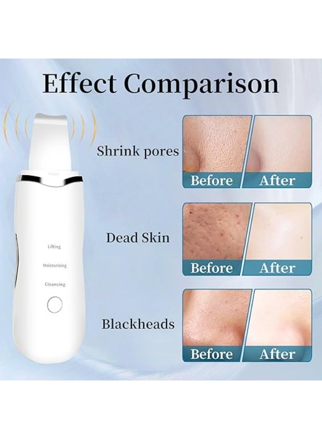 جهاز تنظيف وتقشير البشرة (سكرابر) بثلاثة أوضاع - مقاوم للماء وقابل للشحن - لإزالة الرؤوس السوداء والتنظيف العميق - Image 3