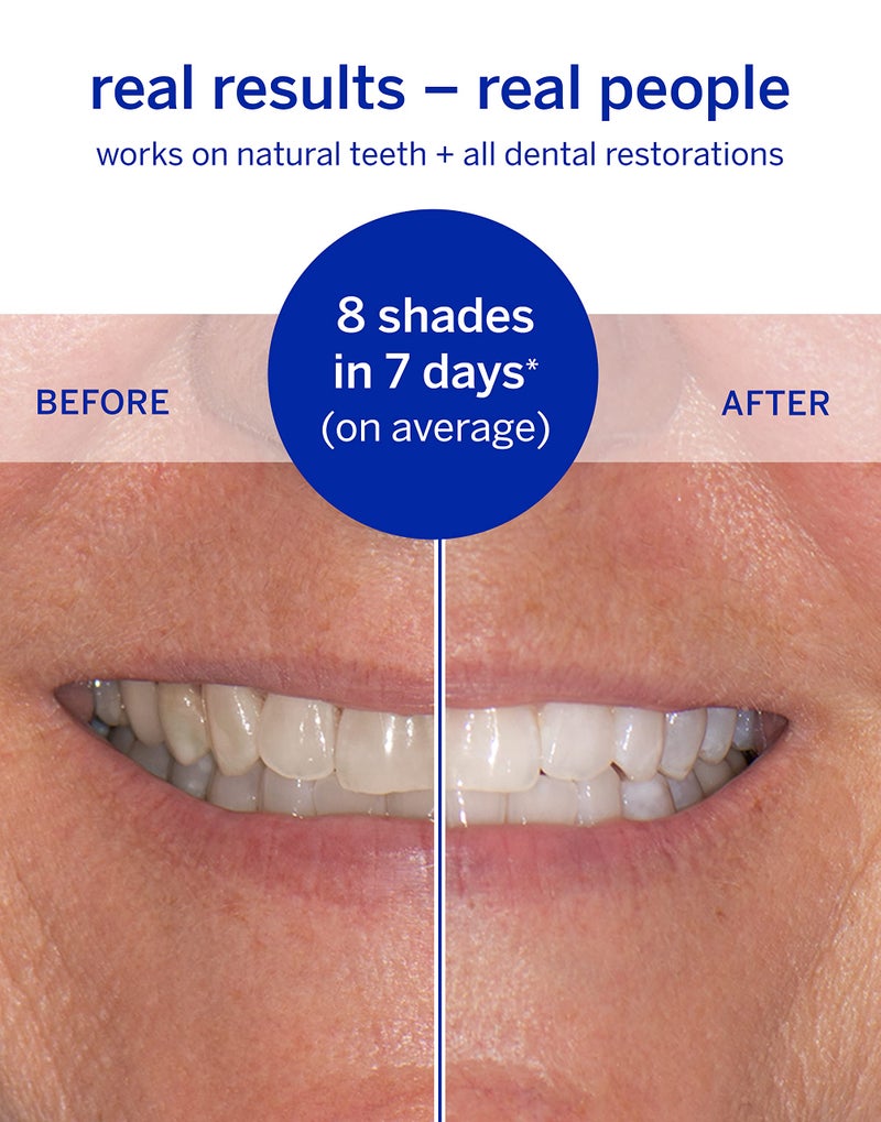 Supersmile Dissolving Superstrips - Professional Teeth Whitening Strips - Enamel Safe Teeth Whitener For Sensitive Teeth - Image 3