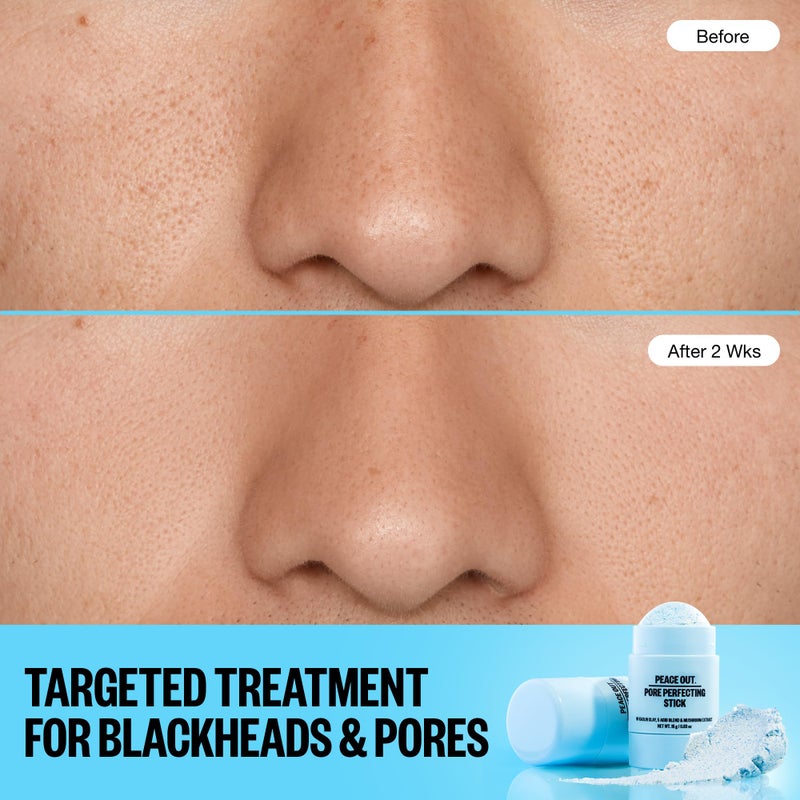 PEACE OUT Pore Perfecting Stick Acne Solution & Blackhead Remover, Glycolic Acid & Salicylic Acid Cleanser, Works Like a Face Wash, Skincare Facial Cleanser & Exfoliating Facial Scrub, 15g /0.53oz - Image 3