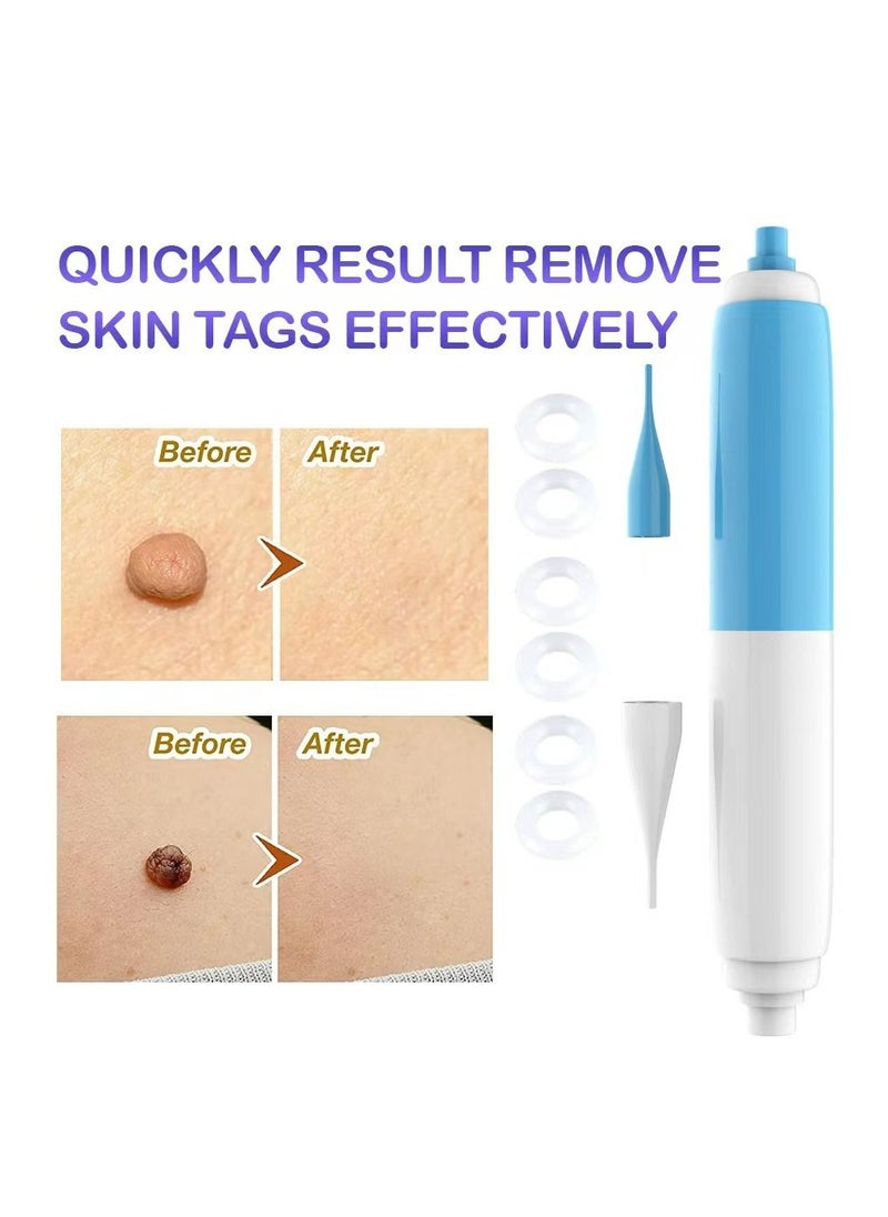 Skin Tag Remover Skin Tag Removal Tool Kit Fleshy Nevus Remover Tool with Micro Skin Tag Bands Smooth Results Skin Tag Remover Device for Small to Medium Skin Tags
