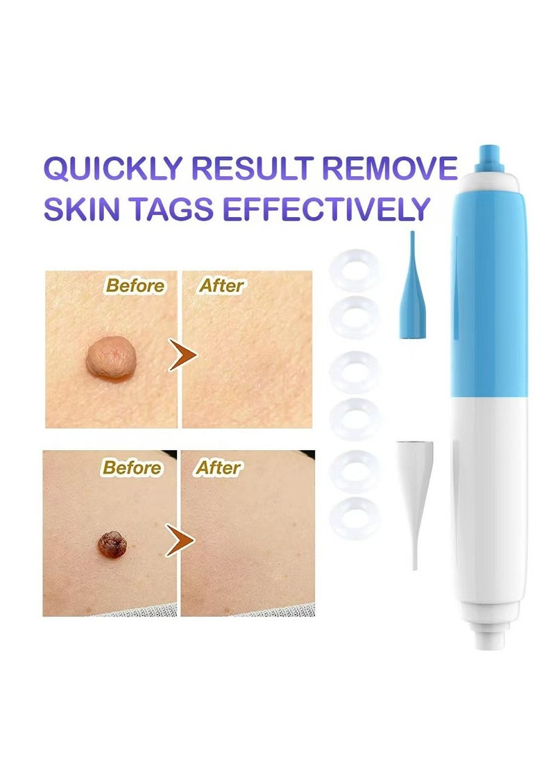 Skin Tag Remover Skin Tag Removal Tool Kit Fleshy Nevus Remover Tool with Micro Skin Tag Bands Smooth Results Skin Tag Remover Device for Small to Medium Skin Tags