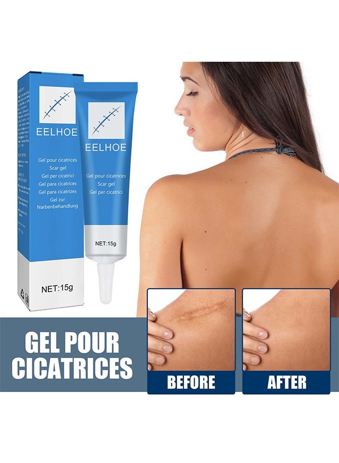 EELHOE Scar gel - Helps Soften And Smooth Raised Scars, Maintaining The Moisture Balance of The Adjacent Skin, Reduces Discolouration, Redness, Pain and Discomfort of Scars 15g - Image 1