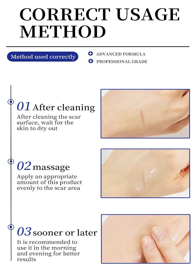 MOIKA Silicone Scar Cream,Scar Gel,Silicone Scar Gel,Advanced Scar Gel,Scar Removal Cream for Surgical Scars,Burn,Acne,Stretch Mark,Keloid Bump - Image 5