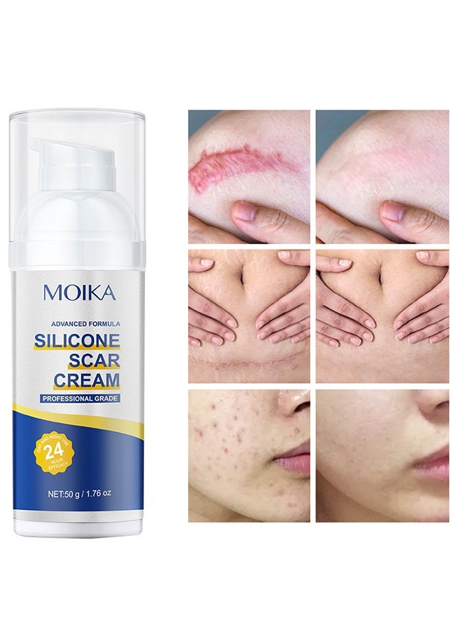 MOIKA Silicone Scar Cream,Scar Gel,Silicone Scar Gel,Advanced Scar Gel,Scar Removal Cream for Surgical Scars,Burn,Acne,Stretch Mark,Keloid Bump - Image 2