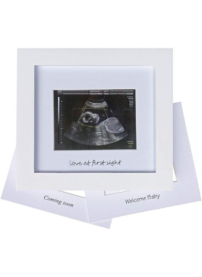 IHEIPYE IHEIPYE Baby Sonogram Photo Frame - 1st Ultrasound Picture Frame - Idea Gift for Expecting Parents, Baby Shower, Gender Reveal Party, Baby Nursery Decor silver text White 16  - Image 1