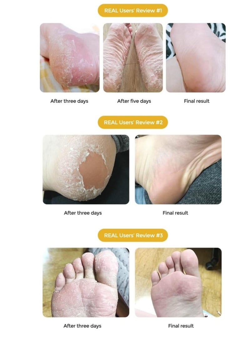 Purederm Exfoliating Foot Mask – Smooth & Refreshed Feet​  - Image 3