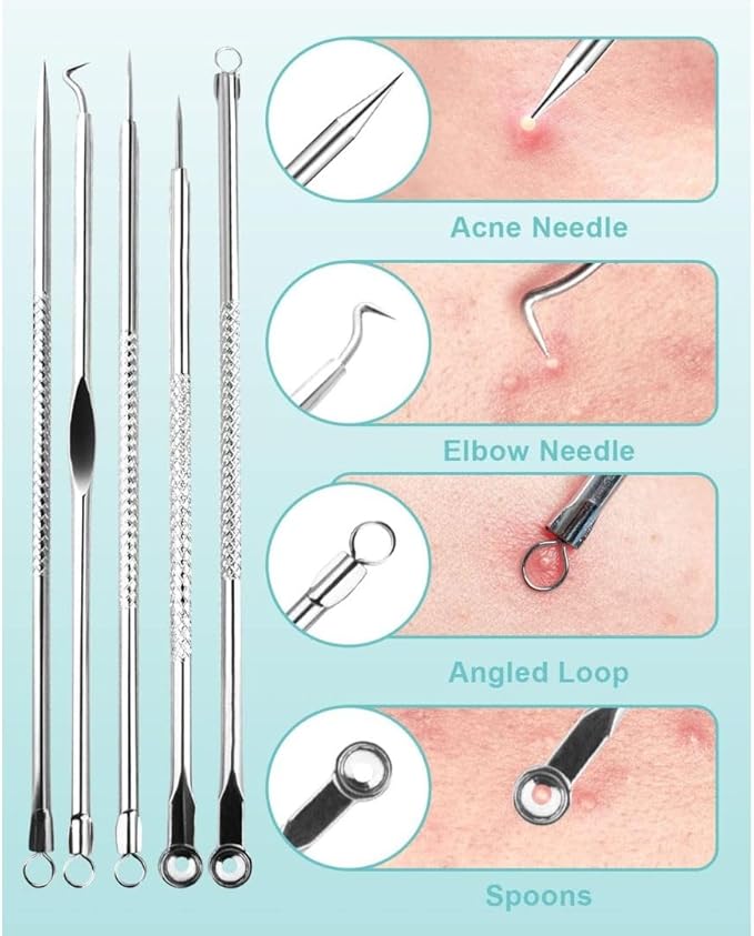 Blackhead Remover Pimple Popping Acne Extraction 4 PCS Tool Set Blemish Scar Care for Facial TreatmentStainless Steel Skin Care Comedone Extractor Zit Removing for Nose Face CheeksRosegold - Image 4