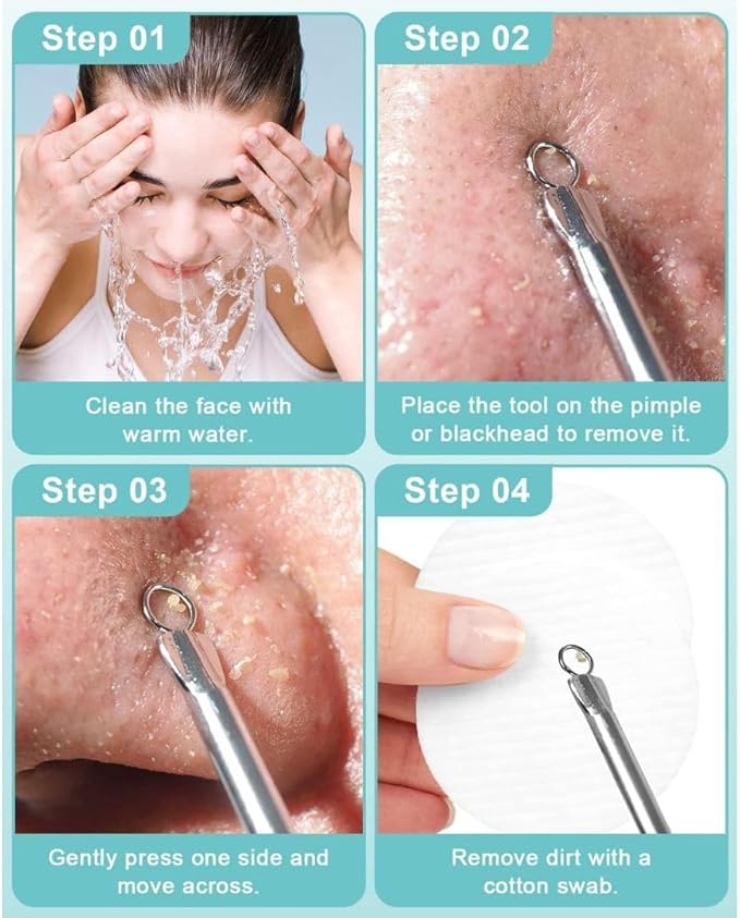 Blackhead Remover Pimple Popping Acne Extraction 4 PCS Tool Set Blemish Scar Care for Facial TreatmentStainless Steel Skin Care Comedone Extractor Zit Removing for Nose Face CheeksRosegold - Image 3