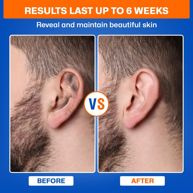 Wokaar 2-in-1 Ear & Nose Waxing Kit for Men & Women | 100g Hair Removal Wax + 99pc | 20 Applicators, 10 Nasal Sticks, 15 Wipes & 20 Earplugs | No Microwave Needed | Nose Wax Kit, Ear Hair Remover - Image 4