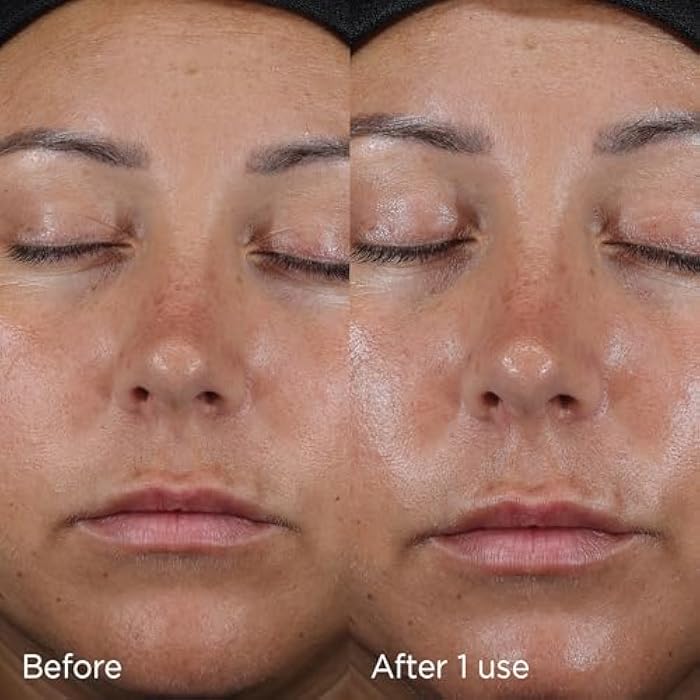 IMAGE Skincare DAILY PREVENTION Ultra Defense Moisturizer, SPF 50 Broad Spectrum Sunscreen, Fragrance Free - Image 4