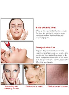 Dr.pen Derma Pen Dr.pen MYM for Acne Scars and Wrinkles  - Image 4