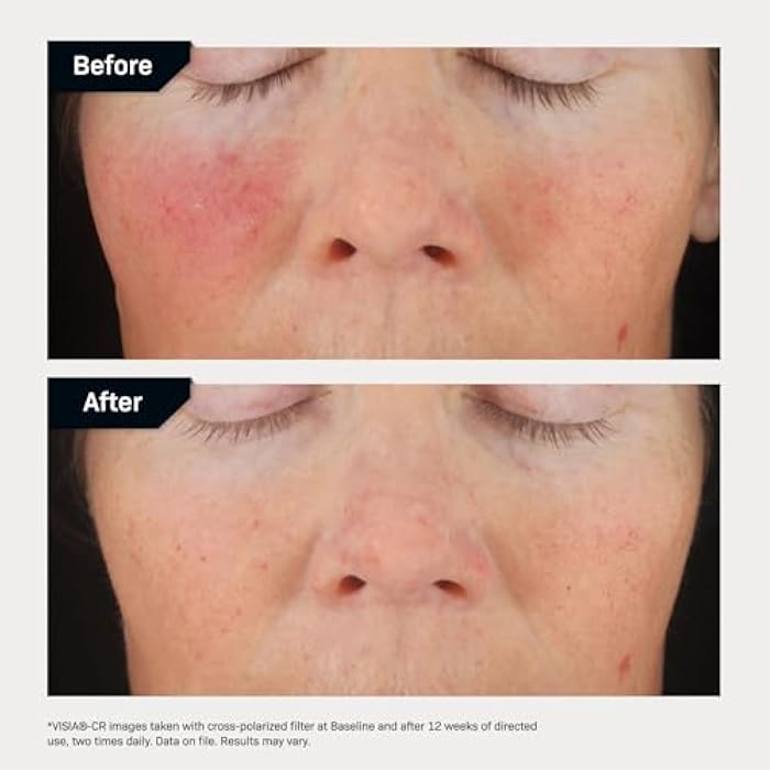 Revision Skincare C+ Correcting Complex 30%® Vitamin C Serum for Face – Anti-Aging Treatment to Brighten Skin, Reduce Fine Lines, Wrinkles & Dark Spots, Firming & Safe for Sensitive Skin - Image 5