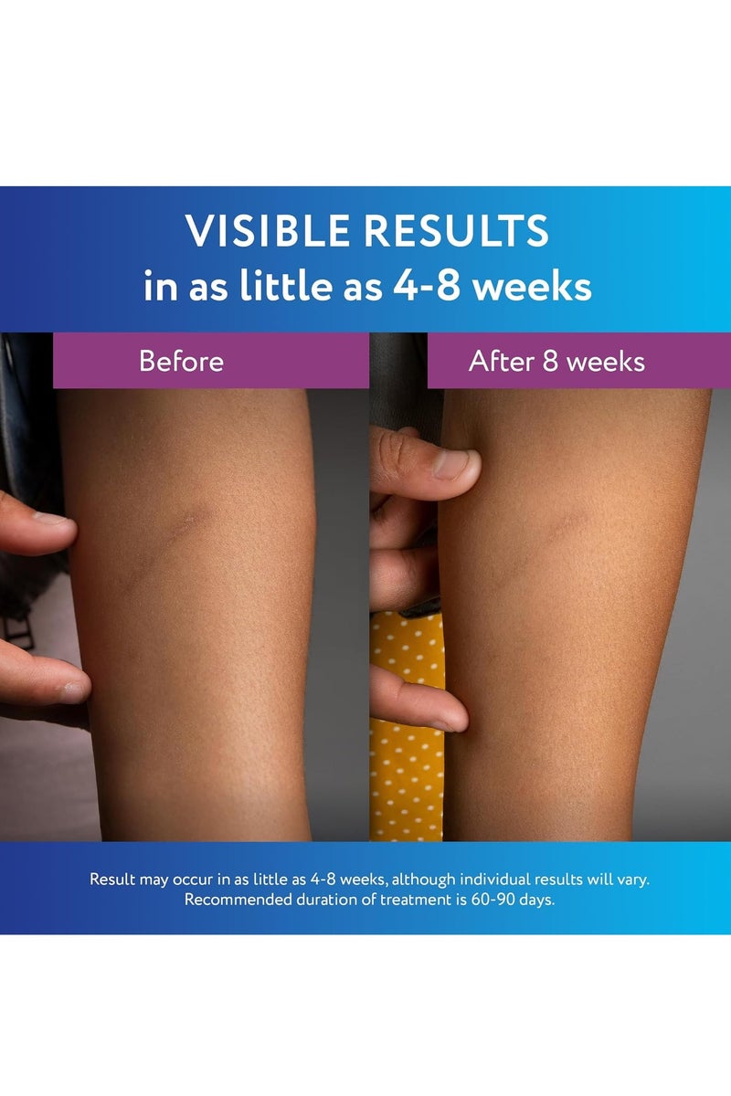 ScarAway Silicone ScarGel 20g - Image 5