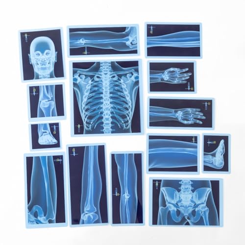 Odoorgames 21 Pieces XRay Sets of Human Skeleton Human Nerves Human Blood Vessels and Human Lymphatic Xray for Light Table - Image 5