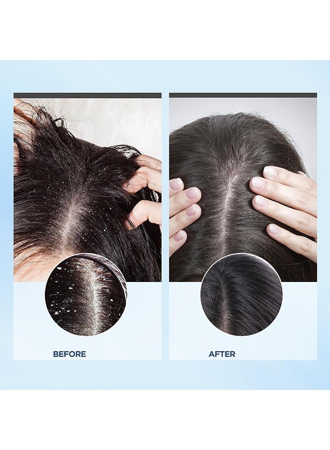 EELHOE Root Restore Hair Scrub，Exfoliating Scalp Scrub, Dandruff Itch Treatment, Hair Detox Scrub, Sulfate-Free Scrub Soothes Dry, Flaky, Itchy Scalp, Removes Buildup 100g - Image 5