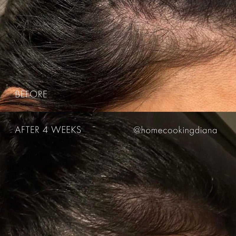 SWEED - The Hair Serum | Nutrient-Rich, Non-Greasy Formula | Easy Roll-On Applicator | Keratin, Biotin, Peptides (6 ml | 0.2 fl oz) - Image 2