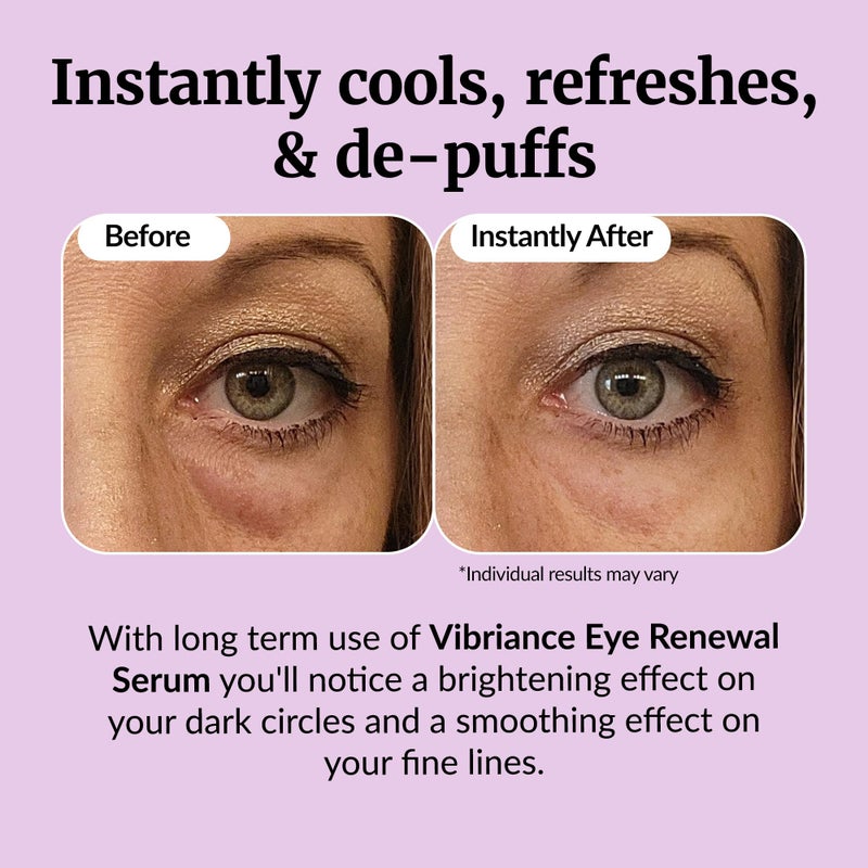 Vibriance Eye Renewal Serum - Dark Circles and Puffiness Treatment - Caffeine Formula for Reducing Bags - Image 4