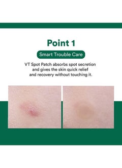 VT COSMETICS Cica x Care Spot Acne Patch - 12 Pcs  - Image 4