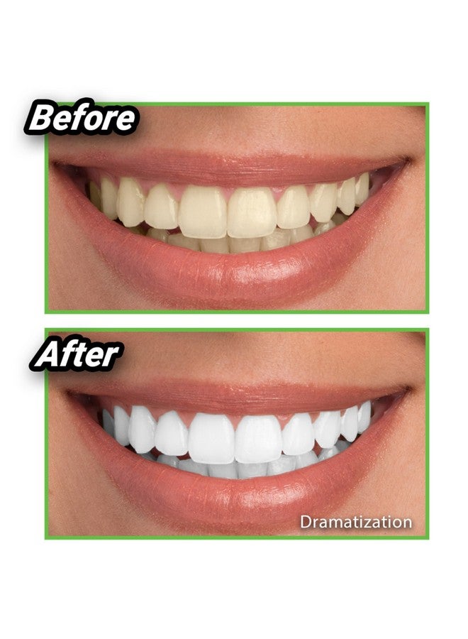 Ontel Miracle Teeth Whitener - Natural Whitening Coconut Charcoal Powder - As Seen on TV - Image 5