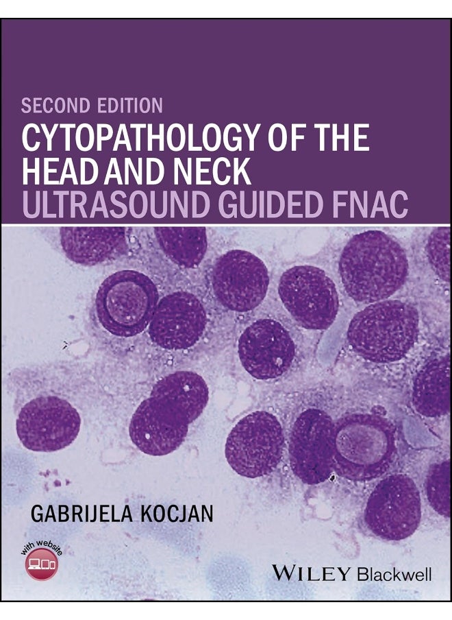 Cytopathology of the Head and Neck: Ultrasound Guided FNAC 