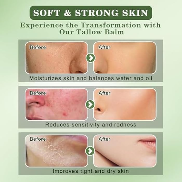 WEILNELL Beef Tallow and Honey Balm for Skin - All-Natural Moisturizer Hydrates and Nourishes the Skin, Grass-Fed Beef Tallow & Honey Balm Blend, Deeply Moisturizing for Face & Body Natural Skin Care - Image 5